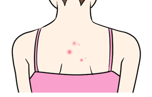 肌質によるトラブル